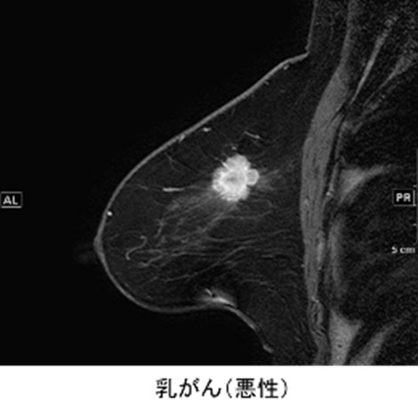 MRI検査画像